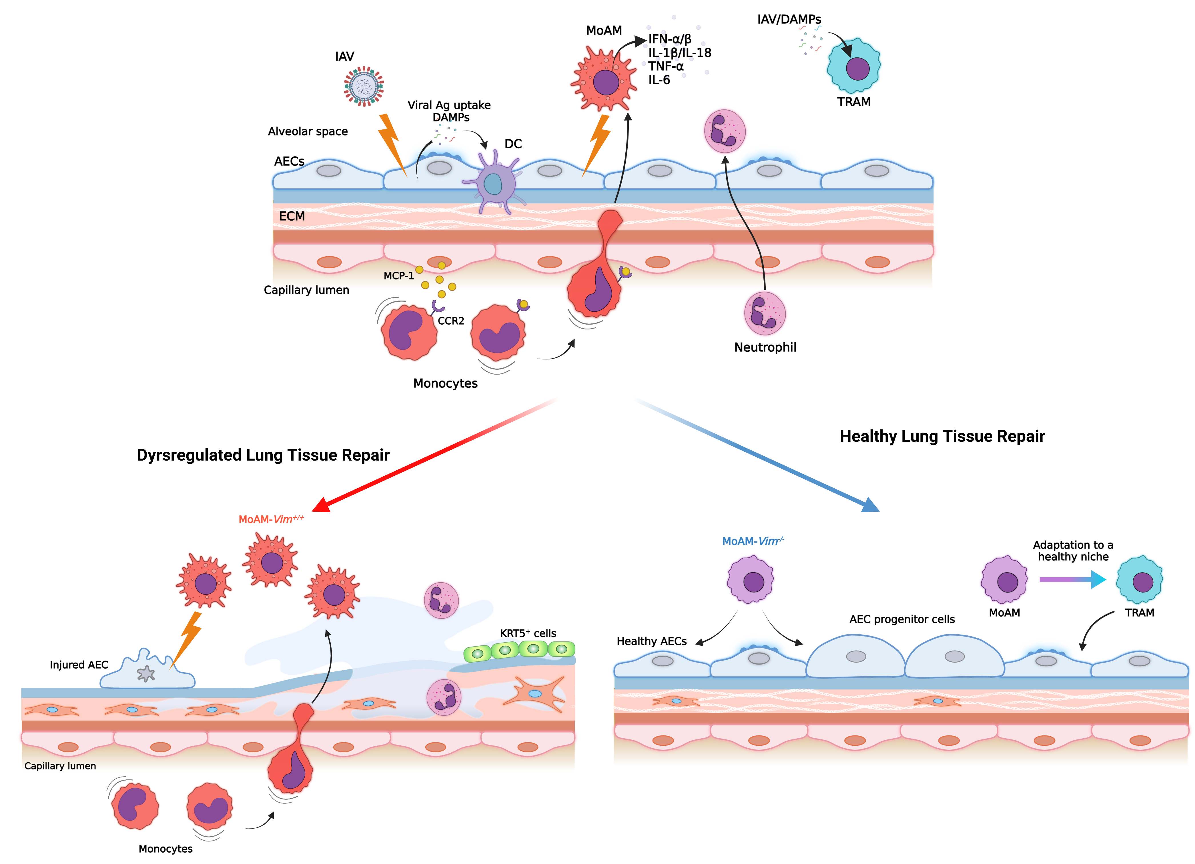 Diagram showing monocyte-derived alveolar macrophages in dysregulated versus healthy lung tissue repair